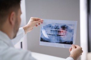 close up of a dentist's hands holding an x-ray and examining it